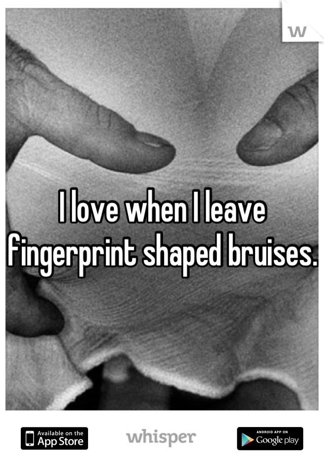 fingerprint-bruises